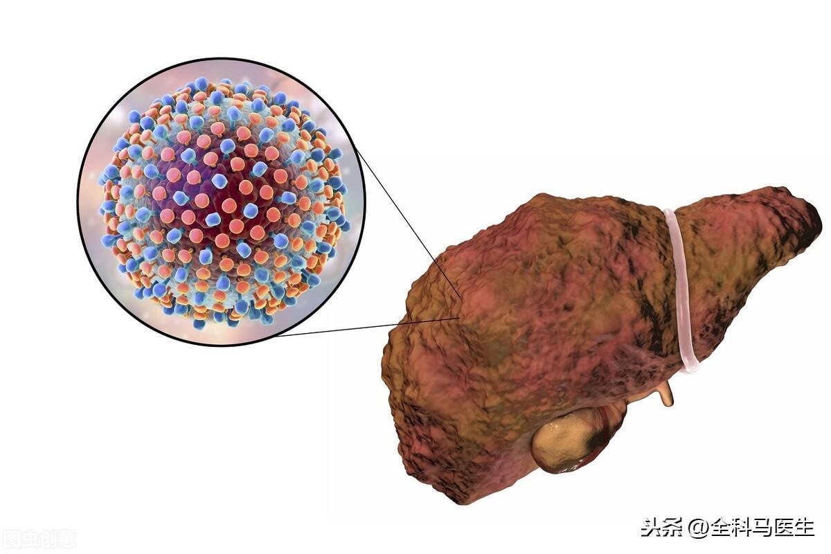 乙肝治疗获重大突破，希望之光引领患者前行之路